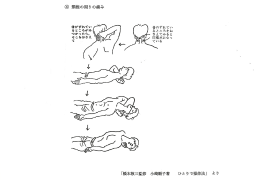 頸椎の周りの痛み