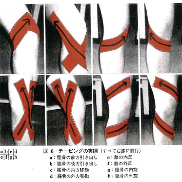 テーピングの実際